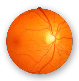 retina2